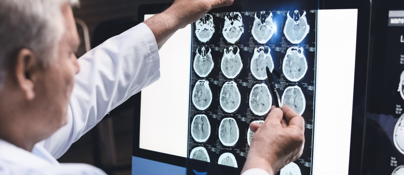 アルツハイマー型認知症 逗子・葉山の認知症と物忘れ・うつと不眠の外来は｜逗葉メモリークリニック